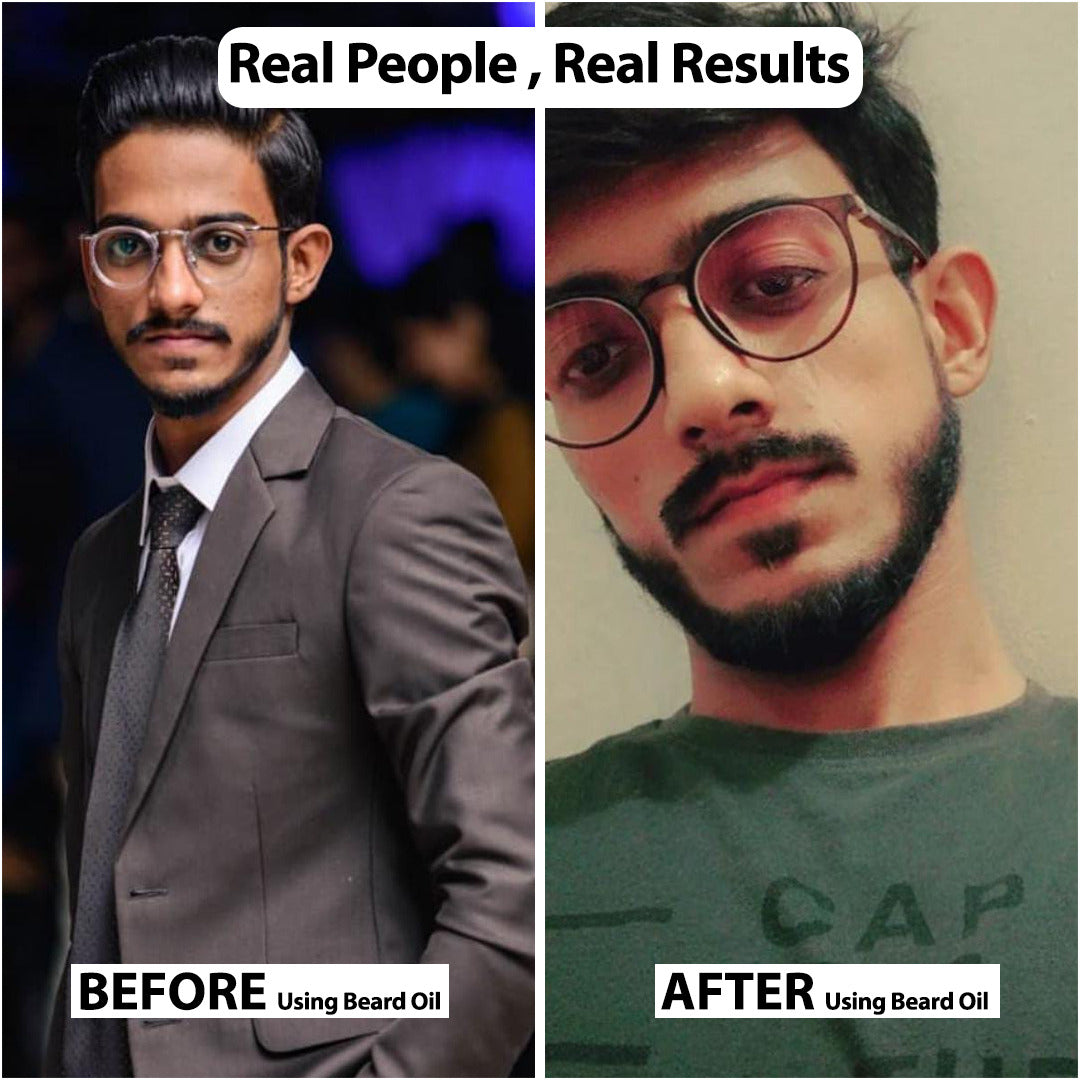 Beard Oil | It's Sunnah ❤️