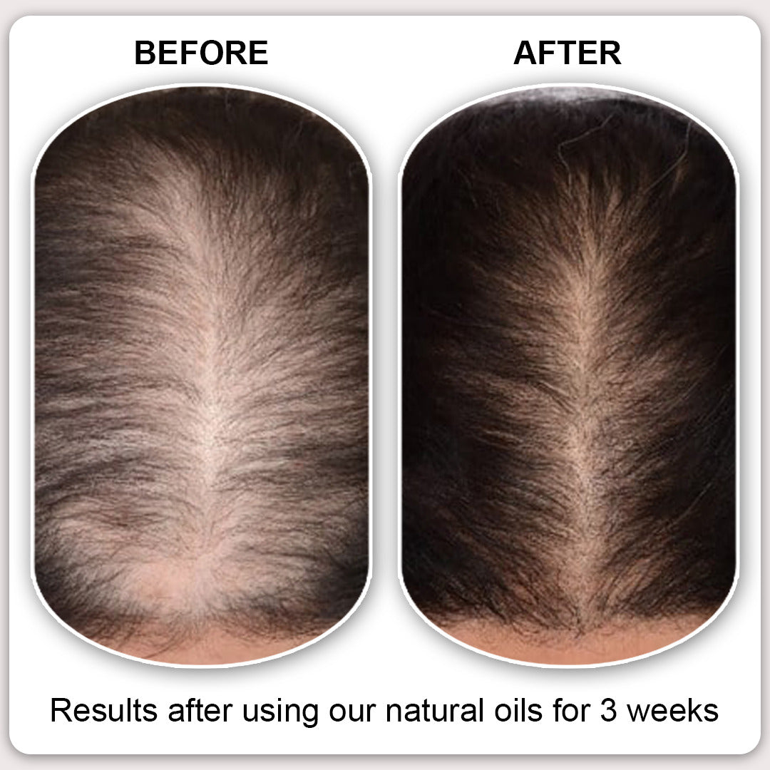 Natural Essential Oils Kit (4 Oils + 2 FREE Oils)
